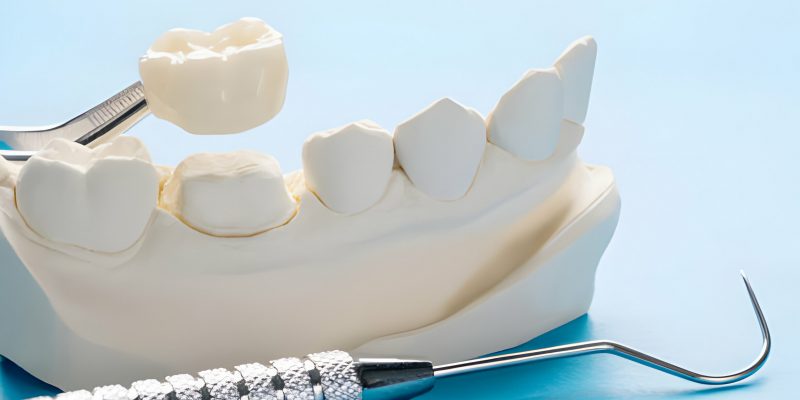 The Different Types of Teeth Extraction: Simple vs. Surgical_FI