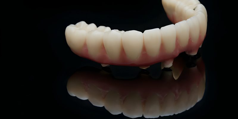 Smile Confidently: A Comprehensive Look at Dentures_FI