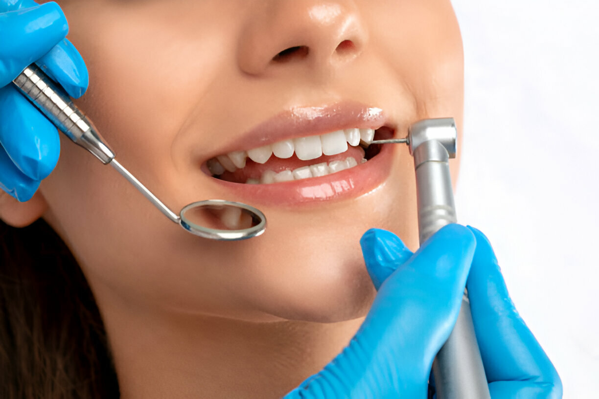 The Importance of Teeth Cleaning: Insights from Four Corners Family Dentistry in Farmington NM_2