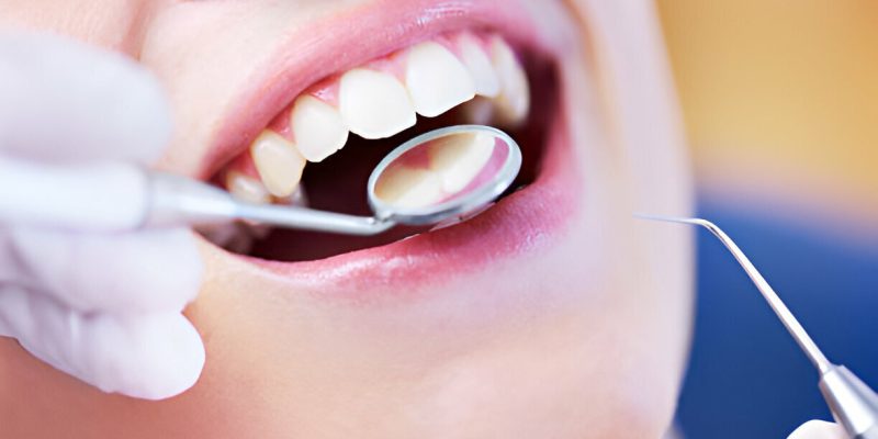 The Importance of Teeth Cleaning: Insights from Four Corners Family Dentistry in Farmington NM_FI